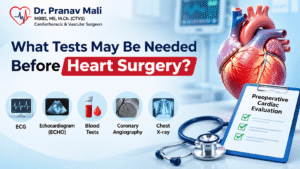 Tests Before Heart Surgery: What to Expect